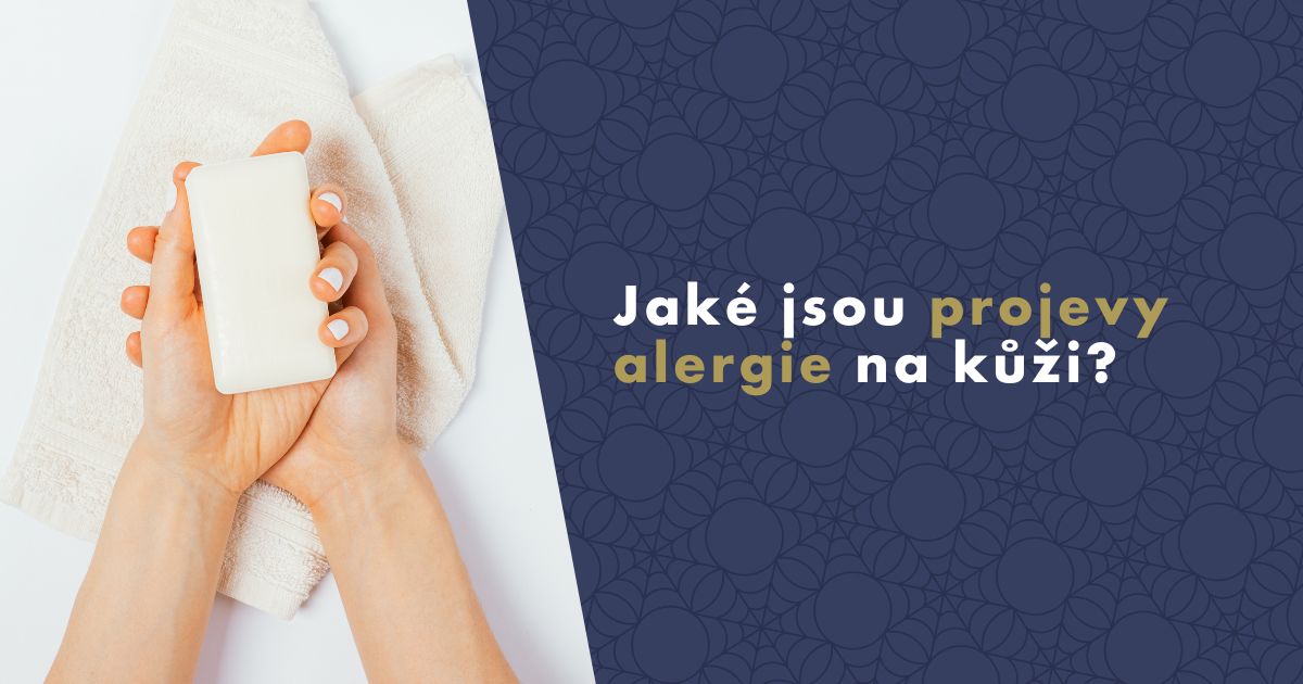 jake-jsou-projevy-alergie-na-kuzi-fb